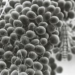 Filossera 3 phylloxera